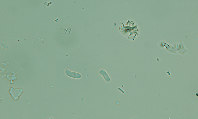 Amylostereum laevigatum? (Peniophora malenonii)